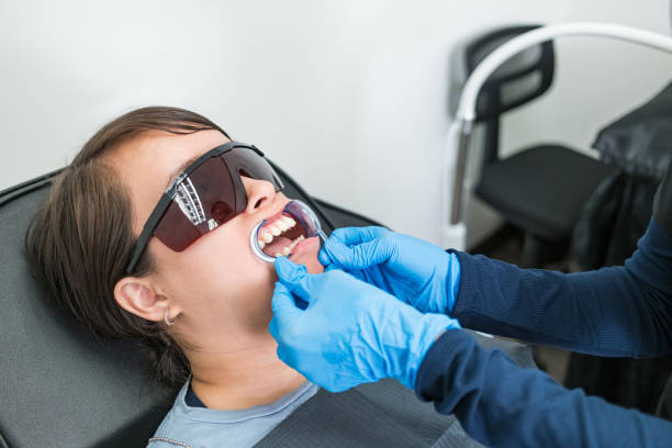Best Emergency Tooth Extraction in Running Springs, CA